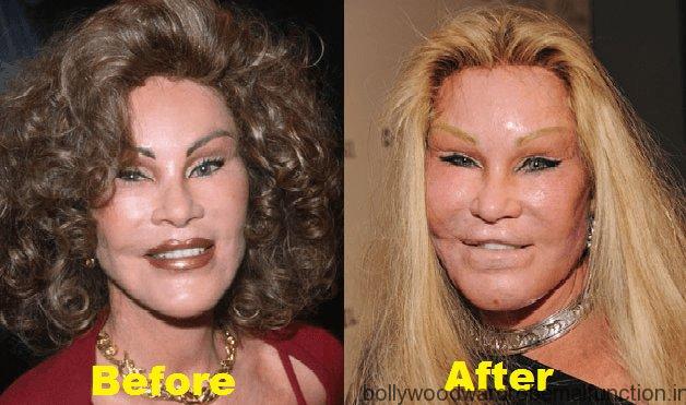 Jocelyn Wildenstein Plastic Surgery
