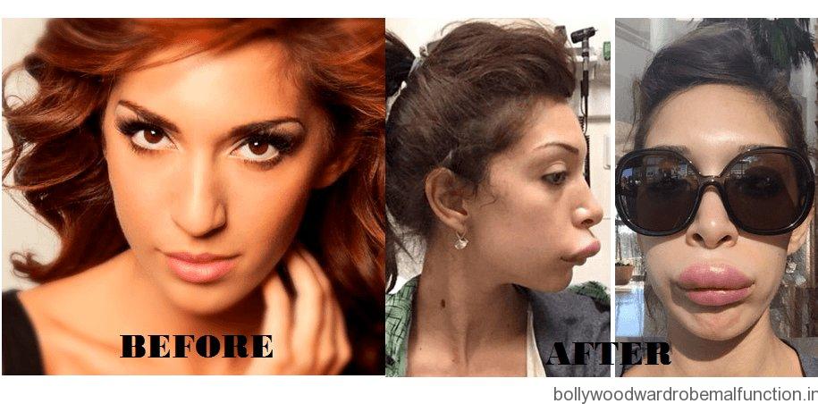 Farrah Abraham Plastic Surgery