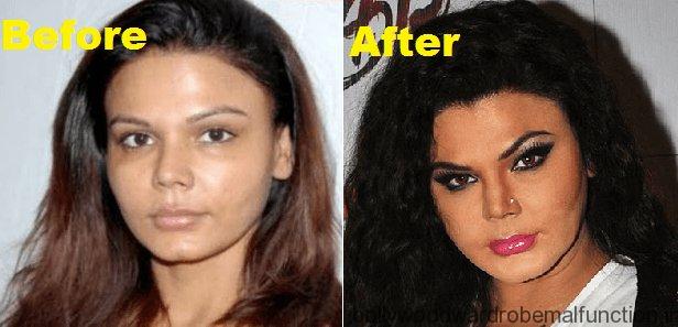 Rakhi Sawant Plastic Surgery