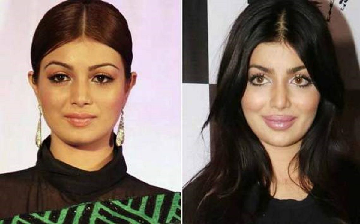 You will be shocked to see Ayesha Takia new look after Lip job and Surgery
