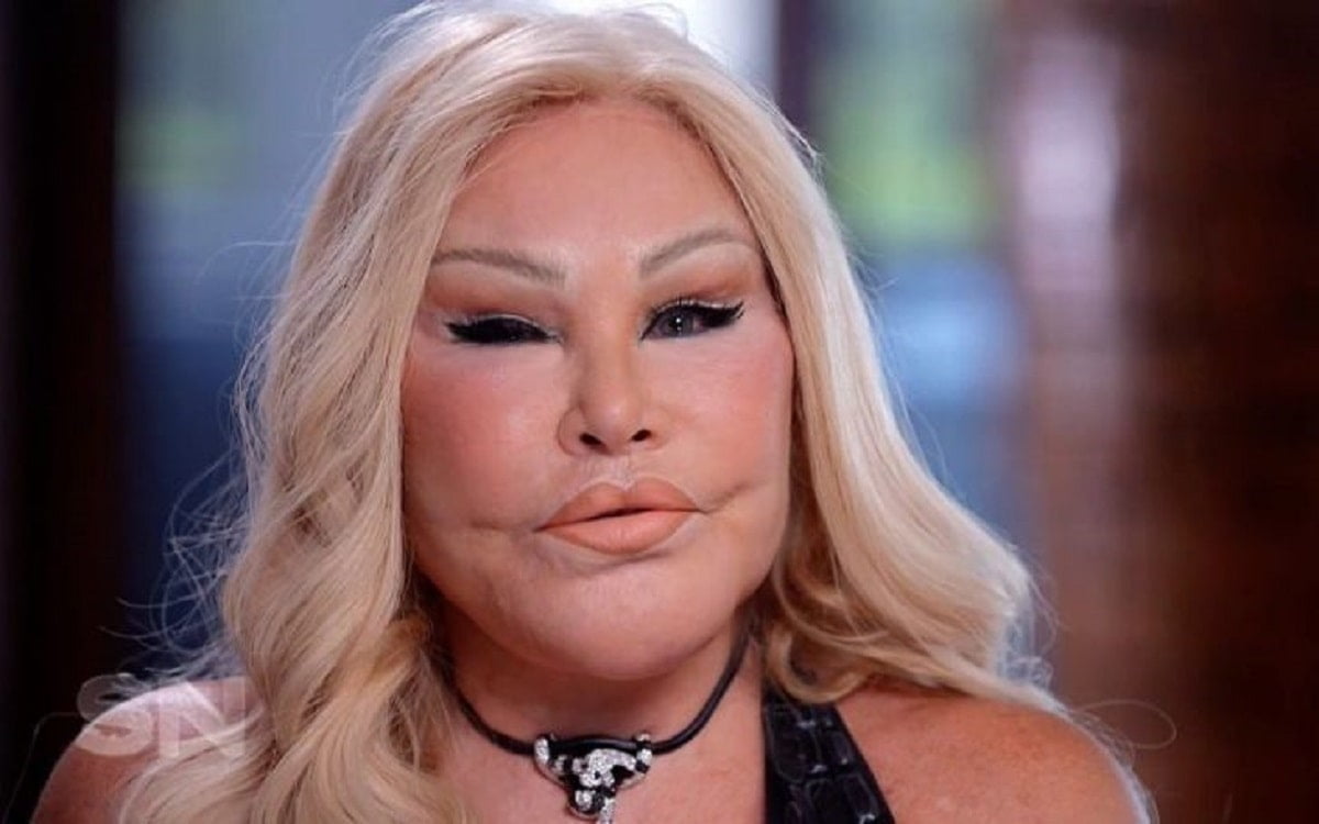 Jocelyn Wildenstein Biography