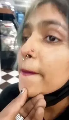 injuries on auzma shaikh's face